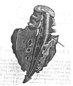 Photo INSERTIONS DE LA DURE-MERE SUR LE RACHIS Une anatomie redécouverte 1