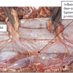 Photo INSERTIONS DE LA DURE-MERE SUR LE RACHIS Une anatomie redécouverte 10