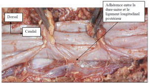 Photo INSERTIONS DE LA DURE-MERE SUR LE RACHIS Une anatomie redécouverte 10