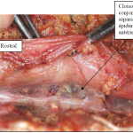 Photo INSERTIONS DE LA DURE-MERE SUR LE RACHIS Une anatomie redécouverte 11