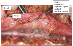 Photo INSERTIONS DE LA DURE-MERE SUR LE RACHIS Une anatomie redécouverte 11