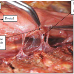 Photo INSERTIONS DE LA DURE-MERE SUR LE RACHIS Une anatomie redécouverte 12