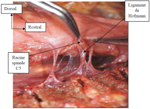 Photo INSERTIONS DE LA DURE-MERE SUR LE RACHIS Une anatomie redécouverte 12