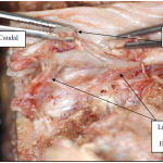 Photo INSERTIONS DE LA DURE-MERE SUR LE RACHIS Une anatomie redécouverte 13