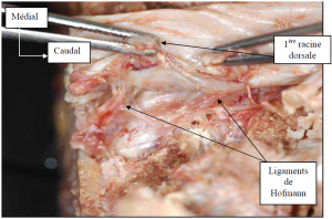 Photo INSERTIONS DE LA DURE-MERE SUR LE RACHIS Une anatomie redécouverte 13