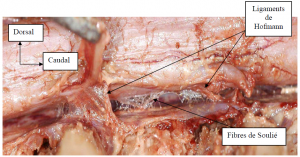 Photo INSERTIONS DE LA DURE-MERE SUR LE RACHIS Une anatomie redécouverte 14