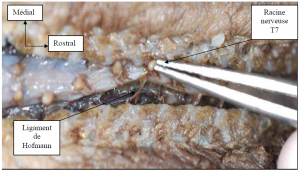 Photo INSERTIONS DE LA DURE-MERE SUR LE RACHIS Une anatomie redécouverte 14