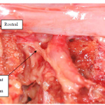 Photo INSERTIONS DE LA DURE-MERE SUR LE RACHIS Une anatomie redécouverte 16