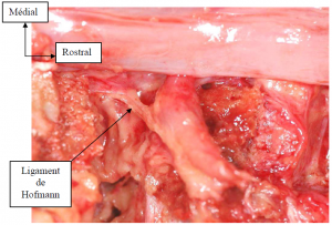 Photo INSERTIONS DE LA DURE-MERE SUR LE RACHIS Une anatomie redécouverte 16