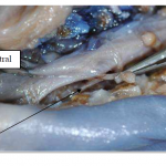 Photo INSERTIONS DE LA DURE-MERE SUR LE RACHIS Une anatomie redécouverte 17