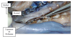 Photo INSERTIONS DE LA DURE-MERE SUR LE RACHIS Une anatomie redécouverte 17