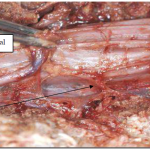 Photo INSERTIONS DE LA DURE-MERE SUR LE RACHIS Une anatomie redécouverte 18