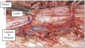 Photo INSERTIONS DE LA DURE-MERE SUR LE RACHIS Une anatomie redécouverte 18