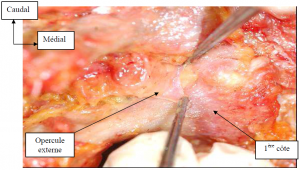 Photo INSERTIONS DE LA DURE-MERE SUR LE RACHIS Une anatomie redécouverte 19