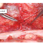 Photo INSERTIONS DE LA DURE-MERE SUR LE RACHIS Une anatomie redécouverte 20