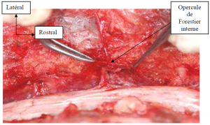 Photo INSERTIONS DE LA DURE-MERE SUR LE RACHIS Une anatomie redécouverte 20