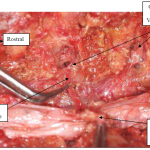 Photo INSERTIONS DE LA DURE-MERE SUR LE RACHIS Une anatomie redécouverte 21