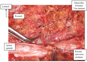 Photo INSERTIONS DE LA DURE-MERE SUR LE RACHIS Une anatomie redécouverte 21