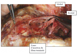 Photo INSERTIONS DE LA DURE-MERE SUR LE RACHIS Une anatomie redécouverte 22