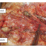 Photo INSERTIONS DE LA DURE-MERE SUR LE RACHIS Une anatomie redécouverte 23