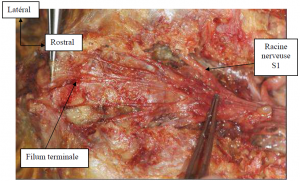 Photo INSERTIONS DE LA DURE-MERE SUR LE RACHIS Une anatomie redécouverte 23