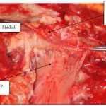 Photo INSERTIONS DE LA DURE-MERE SUR LE RACHIS Une anatomie redécouverte 24