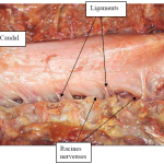 Photo INSERTIONS DE LA DURE-MERE SUR LE RACHIS Une anatomie redécouverte 25