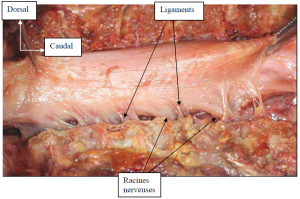 Photo INSERTIONS DE LA DURE-MERE SUR LE RACHIS Une anatomie redécouverte 25