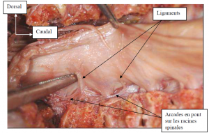 Photo INSERTIONS DE LA DURE-MERE SUR LE RACHIS Une anatomie redécouverte 26