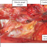 Photo INSERTIONS DE LA DURE-MERE SUR LE RACHIS Une anatomie redécouverte 27