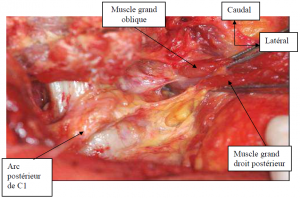 Photo INSERTIONS DE LA DURE-MERE SUR LE RACHIS Une anatomie redécouverte 27