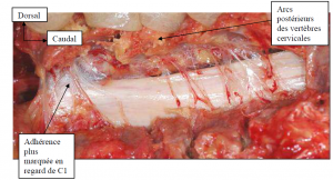 Photo INSERTIONS DE LA DURE-MERE SUR LE RACHIS Une anatomie redécouverte 28