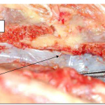 Photo INSERTIONS DE LA DURE-MERE SUR LE RACHIS Une anatomie redécouverte 29