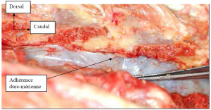 Photo INSERTIONS DE LA DURE-MERE SUR LE RACHIS Une anatomie redécouverte 29