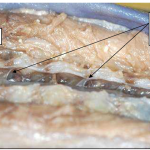 Photo INSERTIONS DE LA DURE-MERE SUR LE RACHIS Une anatomie redécouverte 30