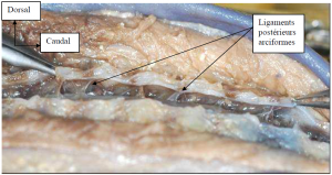 Photo INSERTIONS DE LA DURE-MERE SUR LE RACHIS Une anatomie redécouverte 30