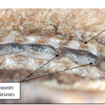 Photo INSERTIONS DE LA DURE-MERE SUR LE RACHIS Une anatomie redécouverte 31