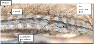 Photo INSERTIONS DE LA DURE-MERE SUR LE RACHIS Une anatomie redécouverte 31