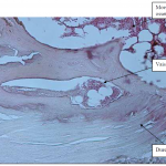 Photo INSERTIONS DE LA DURE-MERE SUR LE RACHIS Une anatomie redécouverte 32