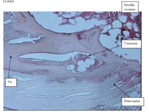 Photo INSERTIONS DE LA DURE-MERE SUR LE RACHIS Une anatomie redécouverte 32