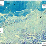 Photo INSERTIONS DE LA DURE-MERE SUR LE RACHIS Une anatomie redécouverte 33