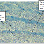 Photo INSERTIONS DE LA DURE-MERE SUR LE RACHIS Une anatomie redécouverte 34