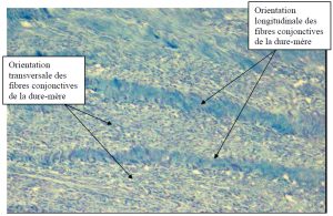 Photo INSERTIONS DE LA DURE-MERE SUR LE RACHIS Une anatomie redécouverte 34