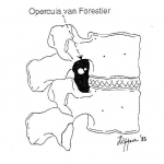 Photo INSERTIONS DE LA DURE-MERE SUR LE RACHIS Une anatomie redécouverte 4