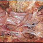 Photo INSERTIONS DE LA DURE-MERE SUR LE RACHIS Une anatomie redécouverte 5