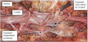 Photo INSERTIONS DE LA DURE-MERE SUR LE RACHIS Une anatomie redécouverte 5