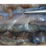 Photo INSERTIONS DE LA DURE-MERE SUR LE RACHIS Une anatomie redécouverte 7