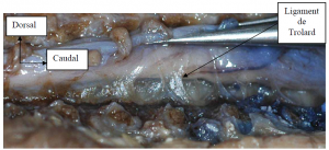 Photo INSERTIONS DE LA DURE-MERE SUR LE RACHIS Une anatomie redécouverte 7