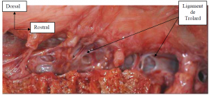 Photo INSERTIONS DE LA DURE-MERE SUR LE RACHIS Une anatomie redécouverte 8